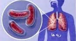 برنامه‌های وزارت بهداشت برای حذف بیماری سل