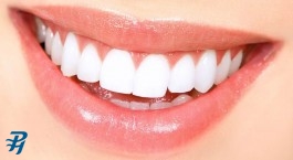 می‌دانید چند صد میلیون تومان دندان در دهانتان دارید؟