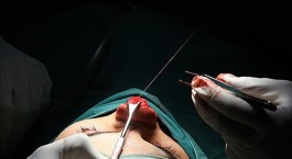 تشدید مجازات تخلفات جراحی‌های زیبایی