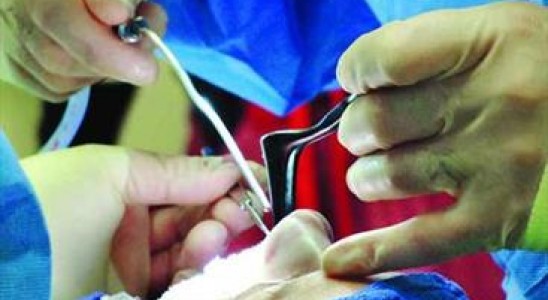 هر هفته ۲ مرگ زیر تیغ جراحان زیبایی غیر مجاز اتفاق می‌افتد