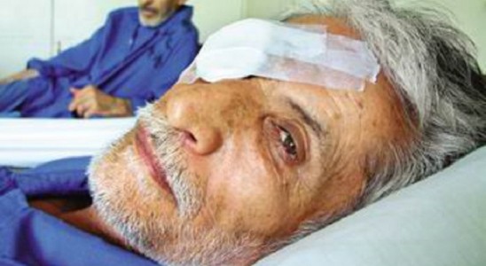 از بین رفتن قرنیه چشم ده ها ایرانی در 10 شهر