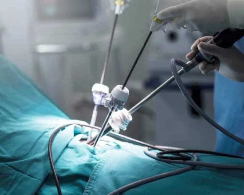 یک دستگاه جدید برای جراحی لاپاروسکوپی مجوز FDA را گرفت