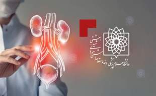 اولین بخش اورولوژی ترمیمی کشور در بیمارستان شهدای تجریش افتتاح می‌شود