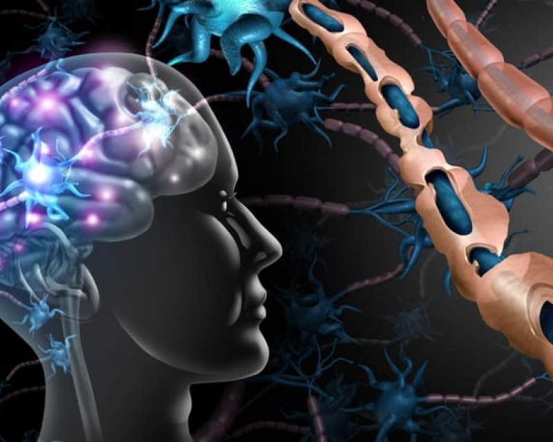 عملکرد امیدوارکننده یک داروی آزمایشی در درمان نوعی MS