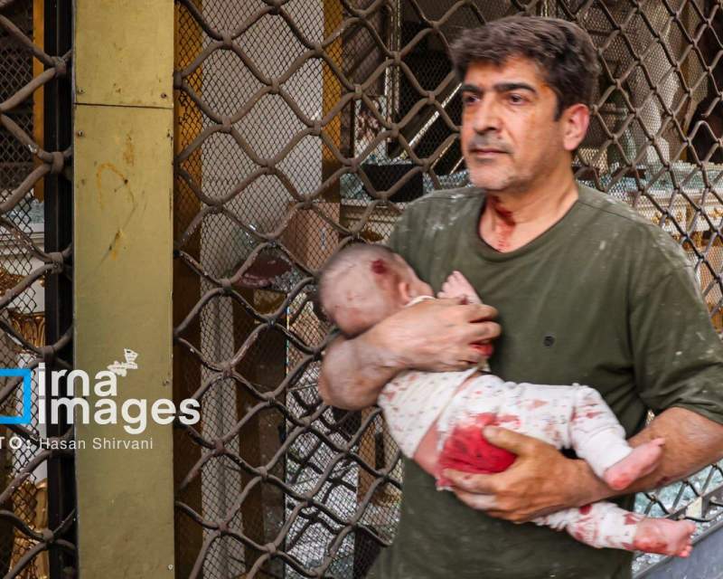 آمار شهدا و مصدومان حملات رژیم حرامزاده صهیونیستی