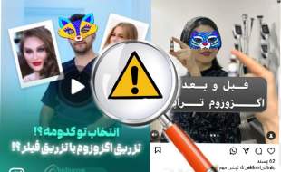 هشدار درباره انجام سلول‌درمانی و اگزوزوم‌تراپی در مراکز فاقد مجوز