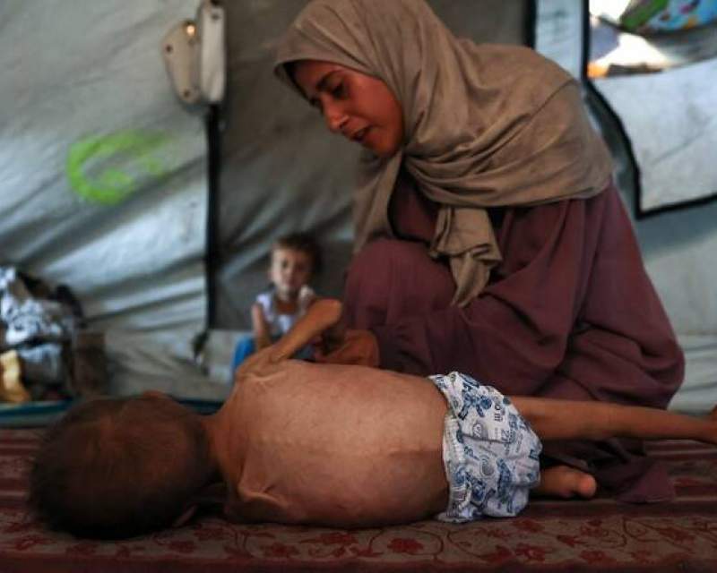 یک‌چهارم از کودکان و زنان باردار در غزه دچار سوءتغذیه هستند