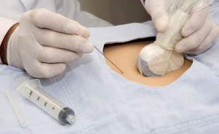 غربالگری پیش از تولد حذف نشده است