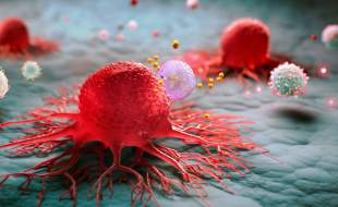 افزایش ۷۵ درصدی مرگ‌های ناشی از‌ سرطان طی ۲۵ سال آینده