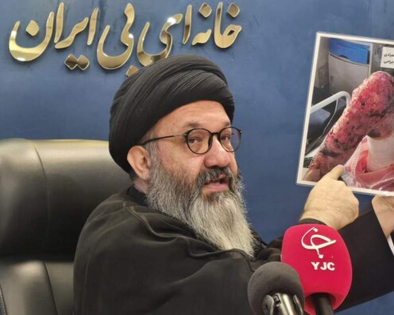 بیمه، پمادها و کرم‌های موردنیاز بیماران پروانه‌ای را جزو اقلام آرایشی می‌داند!