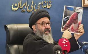 بیمه، پمادها و کرم‌های موردنیاز بیماران پروانه‌ای را جزو اقلام آرایشی می‌داند!