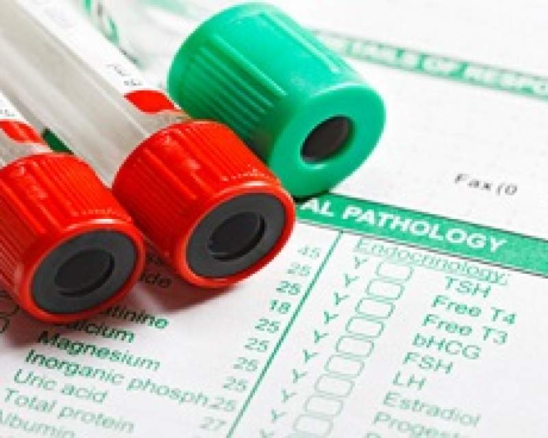 تفسیر نتایج آزمایشهای پزشکی باید فقط توسط پزشکان انجام شود، نه هوش مصنوعی تفسیر نتایج آزمایشهای پزشکی باید فقط توسط پزشکان انجام شود، نه هوش مصنوعی