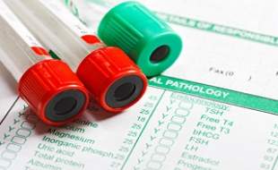 تفسیر نتایج آزمایش‌های پزشکی باید فقط توسط پزشکان انجام شود، نه هوش مصنوعی