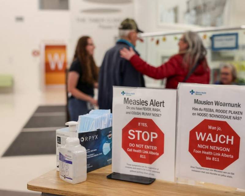 موقعیت کانادا به عنوان کشور عاری از سرخک به خطر افتاد