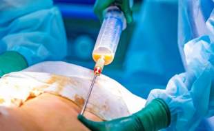 پزشک قلابی در شیراز که در منزل لیپوساکشن می‌کرد، دستگیر شد