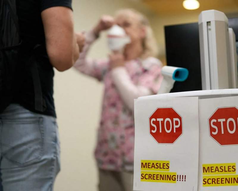 کانادا پس از سه دهه، وضعیت عاری از سرخک را از دست داد