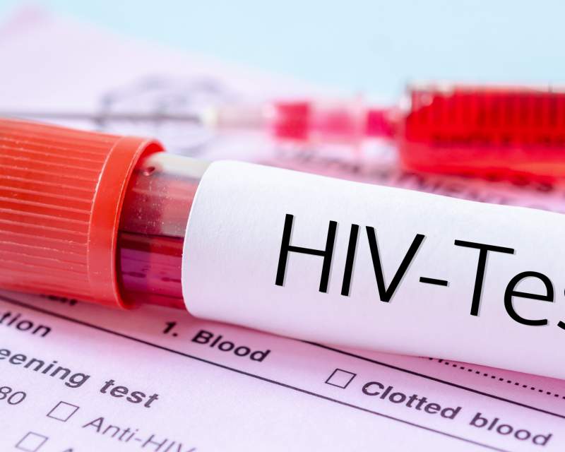 پویش ملی «من هم تست اچ‌آی‌وی می‌دهم»؛ گامی برای عبور از موانع