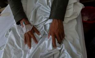 میزان ابتلا به سل در جهان کاهش یافت