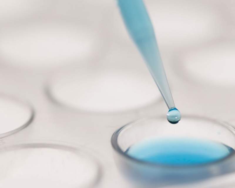 شناسایی نوع وحشی ویروس فلج اطفال در فاضلاب آلمان