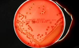 افزایش ۱۷ درصدی مرگ‌ومیرهای مرتبط با ابرمیکروب‌های مقاوم به آنتی‌بیوتیک در انگلستان