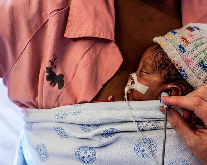 مراقبت مادرانه کانگورویی؛ نجات‌بخش نوزادان نارس