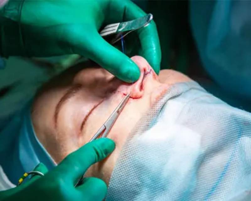 حدود ۴۰ نفر قربانی تزریق ژل تقلبی هستند