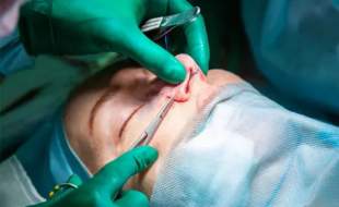 حدود ۴۰ نفر قربانی تزریق ژل تقلبی هستند