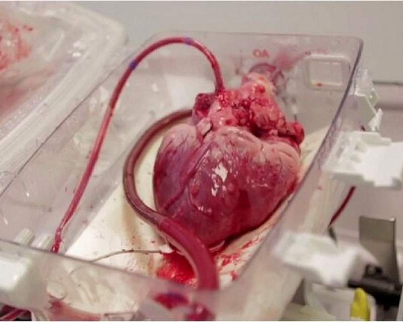 قلب اهدایی با جت فالکون از رشت به تهران آمد