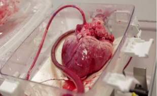 قلب اهدایی با جت فالکون از رشت به تهران آمد