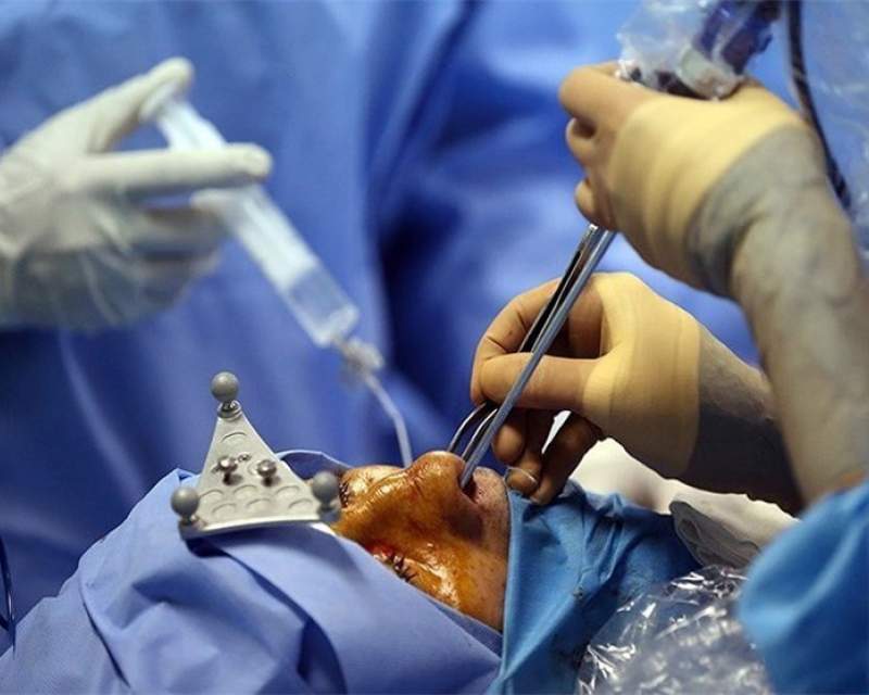 جراحی بینی بدون بیهوشی توسط دستیار دیپلمه پزشک مدعی!