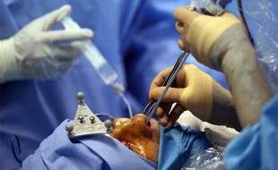 جراحی بینی بدون بیهوشی توسط دستیار دیپلمه یک پزشک!