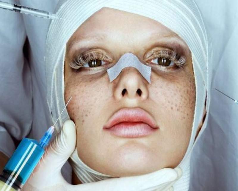 "بلک فرآیدی" تله تبلیغاتی کلینیک‌های زیبایی برای جذب مشتری