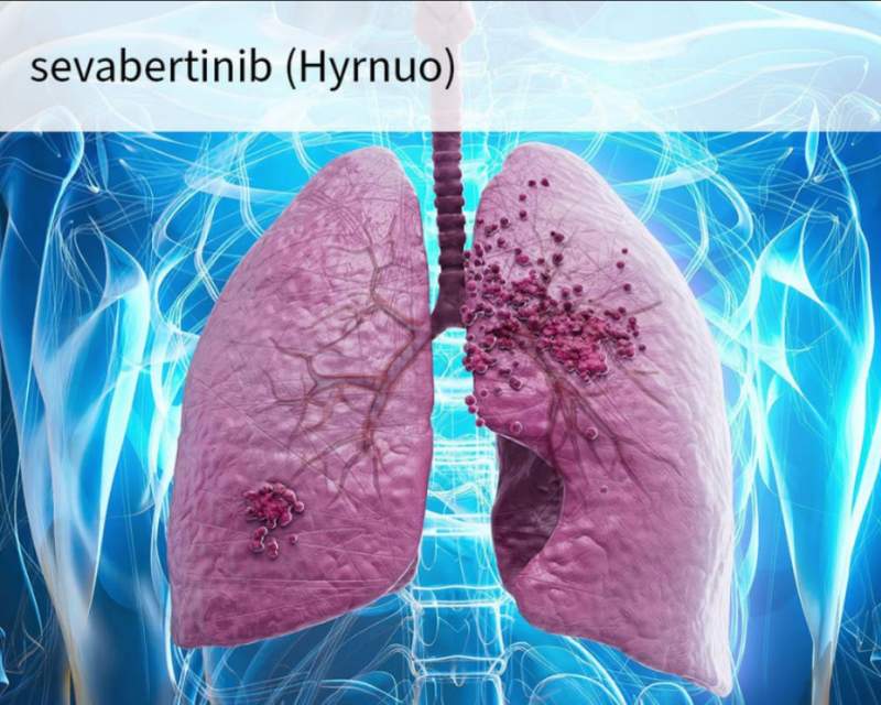 داروی شرکت بایر برای یک نوع سرطان ریه تائید شد داروی شرکت بایر برای یک نوع سرطان ریه تائید شد