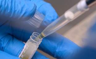 کاهش بودجه تحقیقات پزشکی در آمریکا و بلاتکلیفی بیش از ۷۴ هزار بیمار