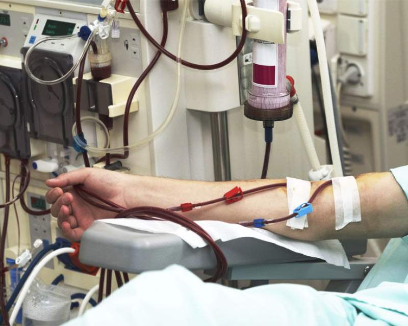 توقف توزیع داروی «مایفورتیک»؛ برخی بیماران پیوندی در معرض خطر رد عضو