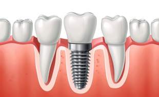 صداوسیما در حال پخش تبلیغات غیرمجاز یک کلینیک دندانپزشکی است