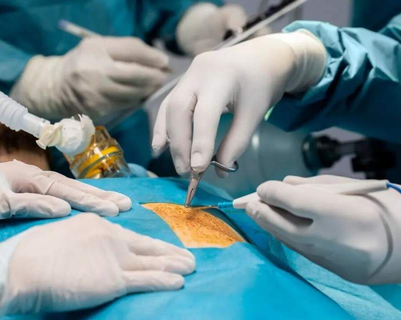 توده عجیب خرمالو در معده چند بیمار