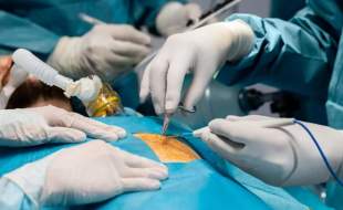 توده عجیب خرمالو در معده چند بیمار